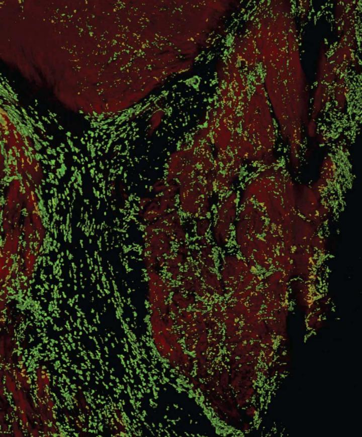 Cardiomyocytes and Macrophages