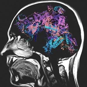 Magnetic Resonance Imaging Of The Brain