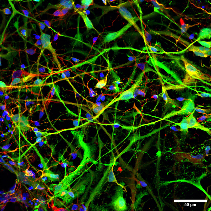 Neuron-like cells derived from stem cells provide insights on gene activity and addiction