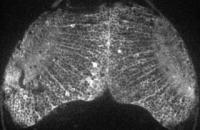 Spontaneous Neuronal Activity in the Optic Tectum in a Zebrafish Larva