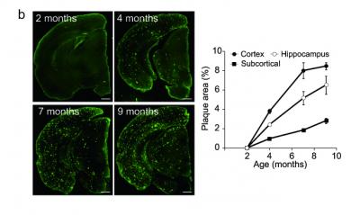 Abeta Deposition in the Second Model (APPNL-G-F/NL-G-F) Brains