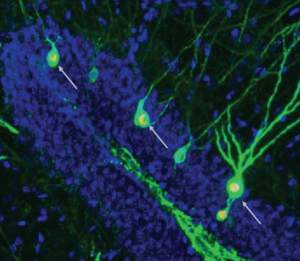 Memory-storing neurons in the hippocampus of mice with AD.