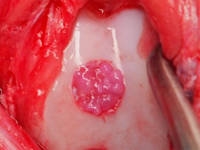 Translantation of the Particles