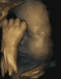 Fetus at 32 Weeks (2)
