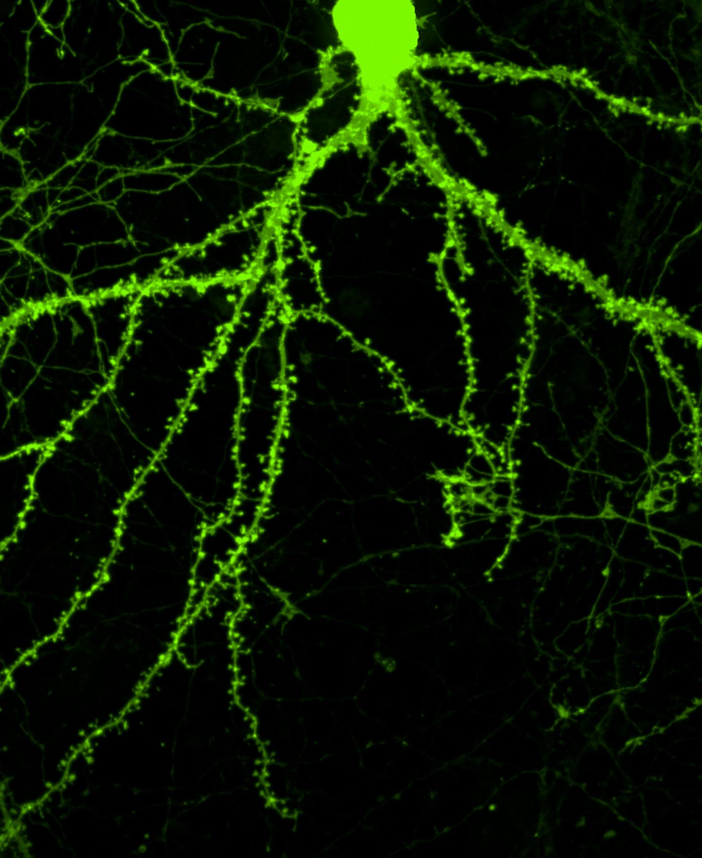 Dendritic Spines Sprout on a T [IMAGE] EurekAlert! Science News Releases