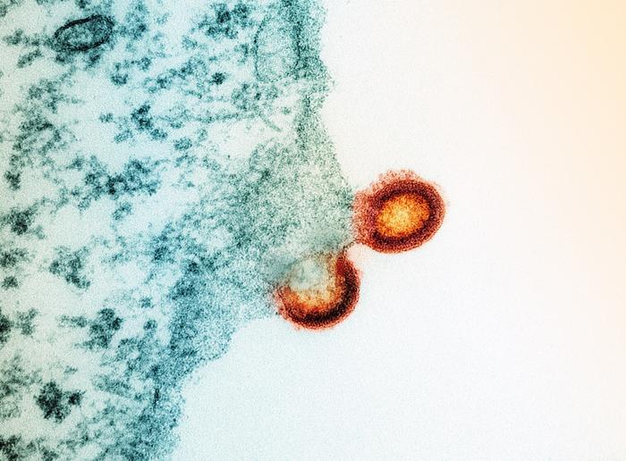 Two HIV-1 virus particles