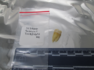 Tooth from medieval Jewish cemetery