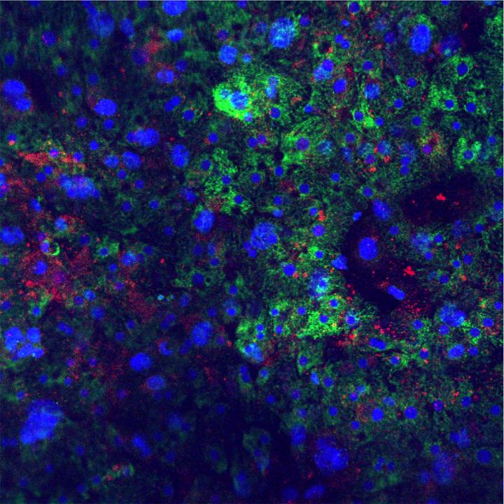 Liver Cell Culture System