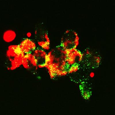 Confocal Microscopy Detecting Mitochondria Colocalization with Autophagosomes