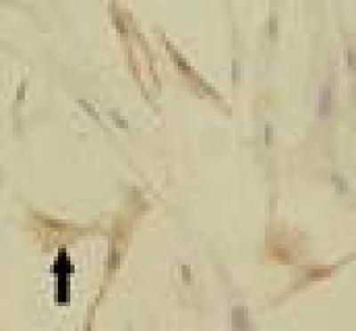 Fibroblast Growth Factor Combined with Heparin