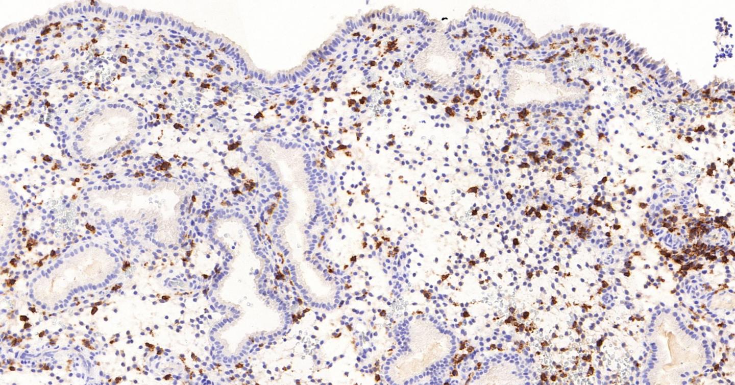 Human Embryo Cultured with Decidual Cells in the Lab