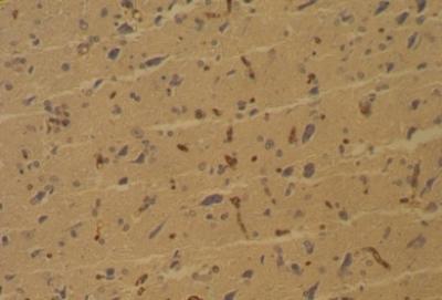 Immunohistochemistry