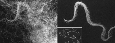 Sperm Conjugate from a Diving Beetle