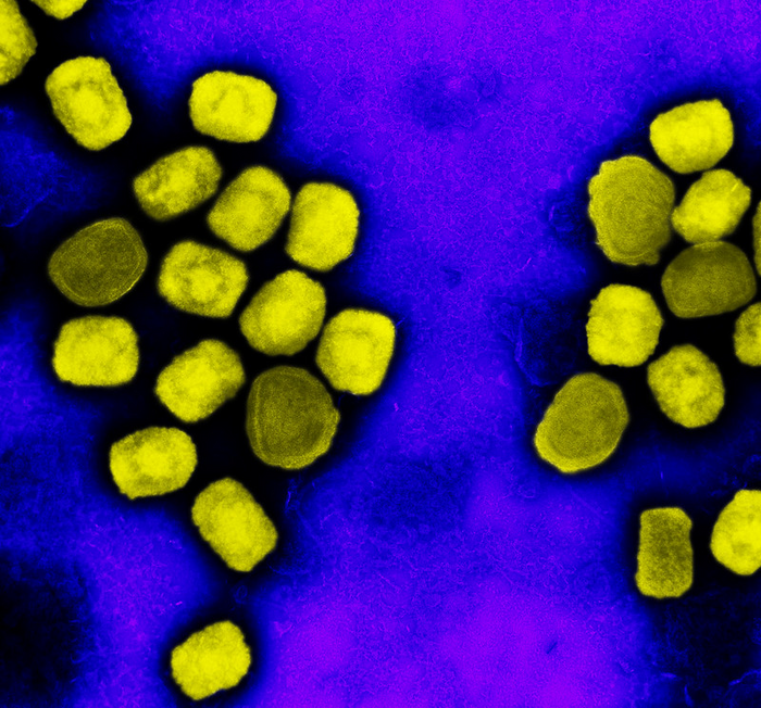 mpox virus particles