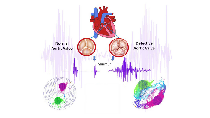 Normal Aortic Valve (left) Ver [IMAGE] | EurekAlert! Science News Releases