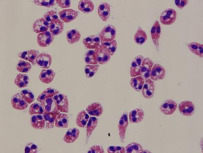 Eosinophils