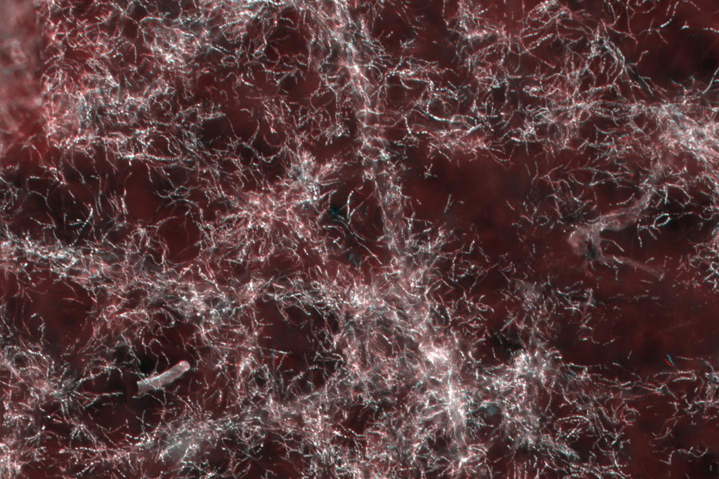 Fluorescence in situ Hybridization
