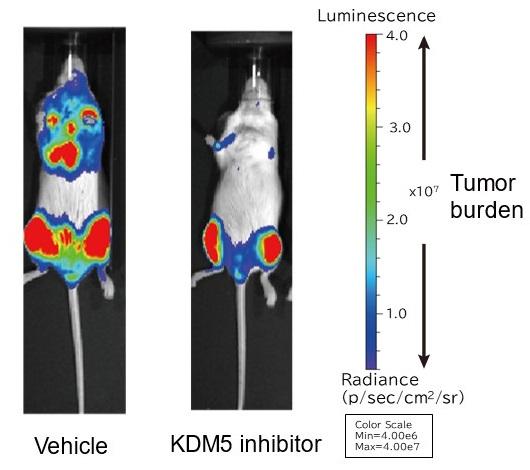 KDM5 inhibitor suppressed myeloma cell growth