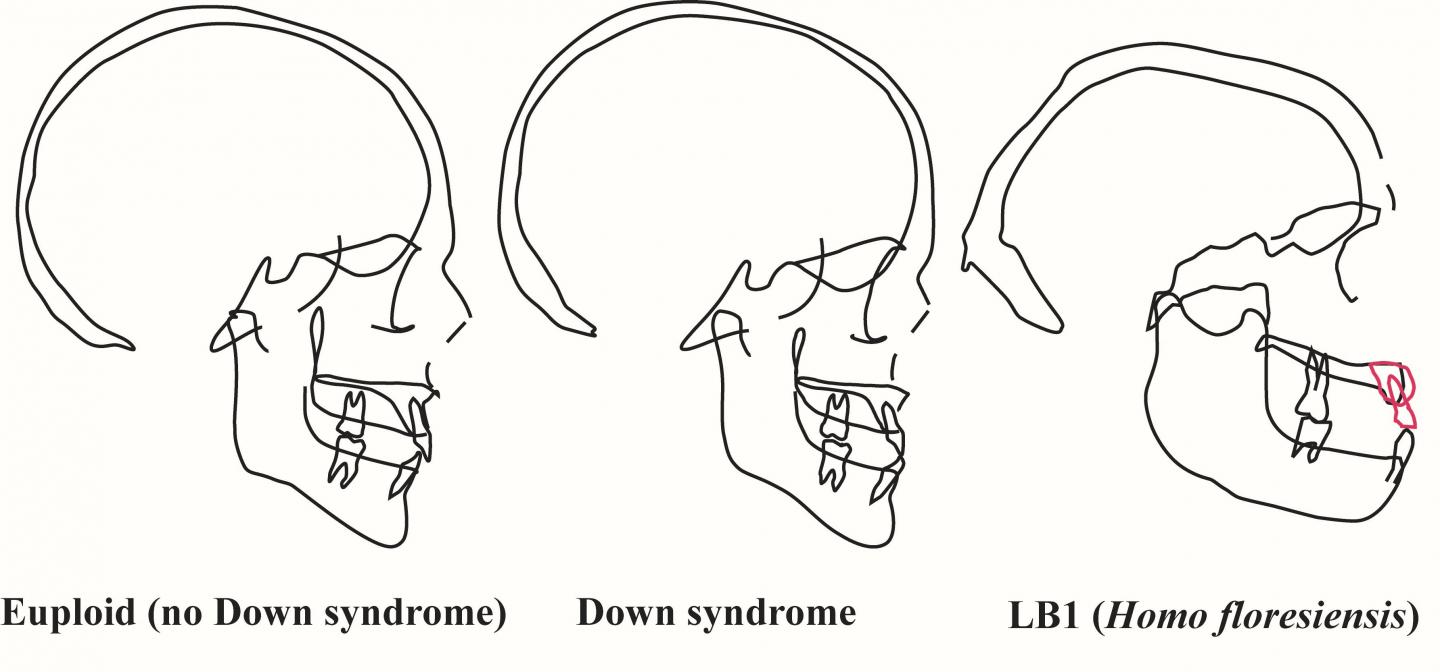 Skull Profile Comparison