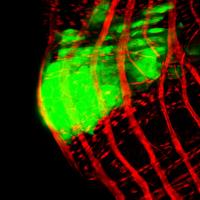 Tumor-Like Growth in <i>Drosophila</i> Gut