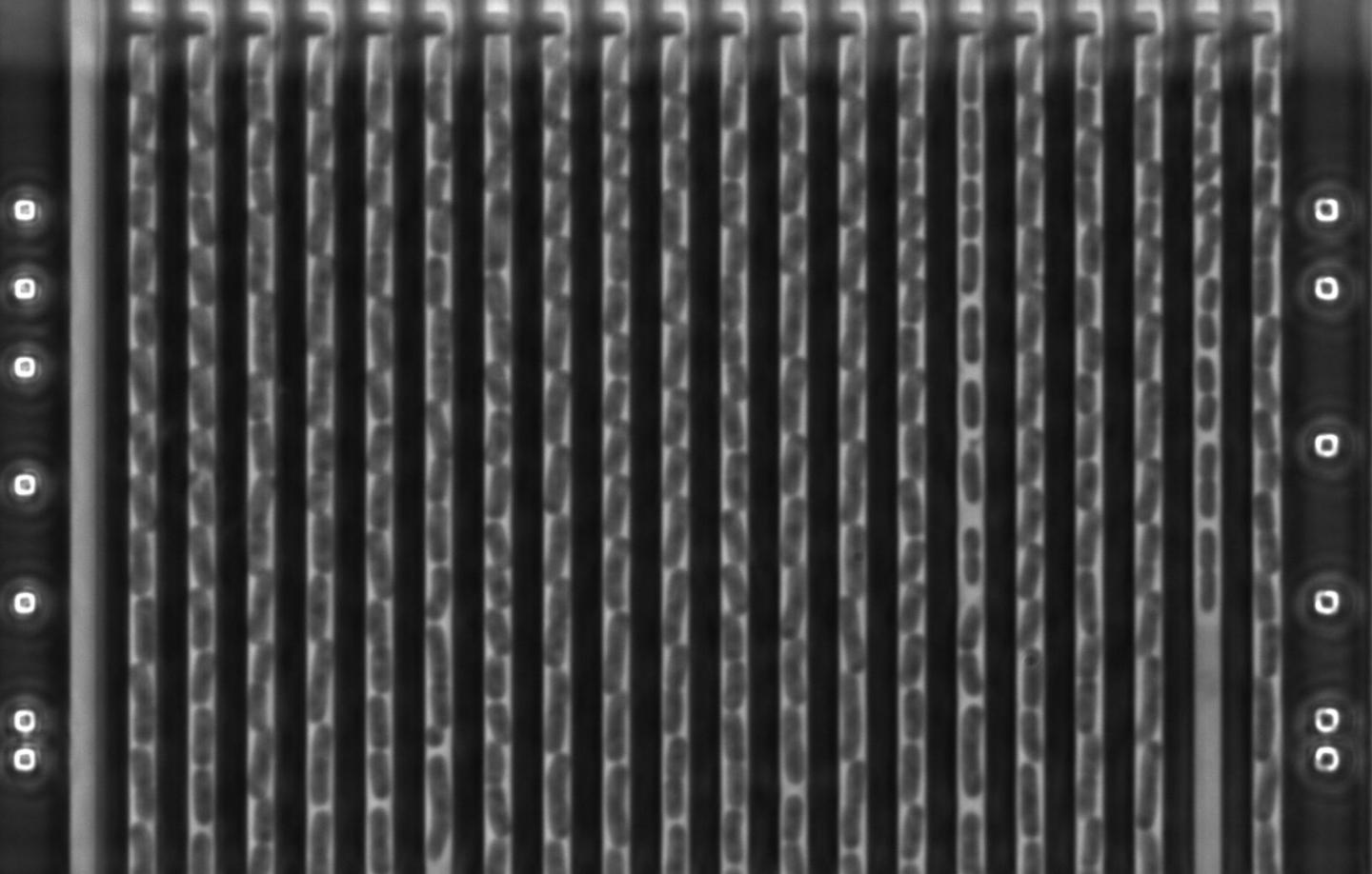 <i>Klebsiella pneumoniae</i>