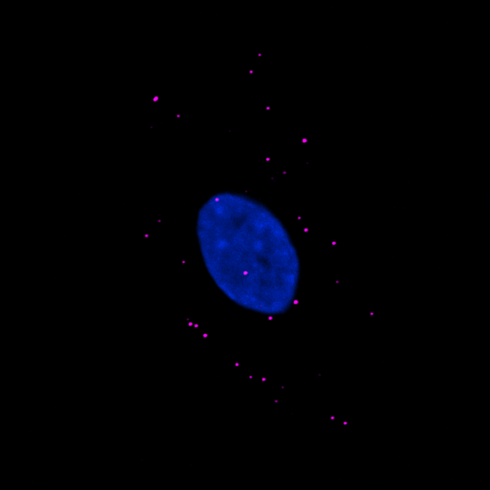Phase separation found in immune response within cells