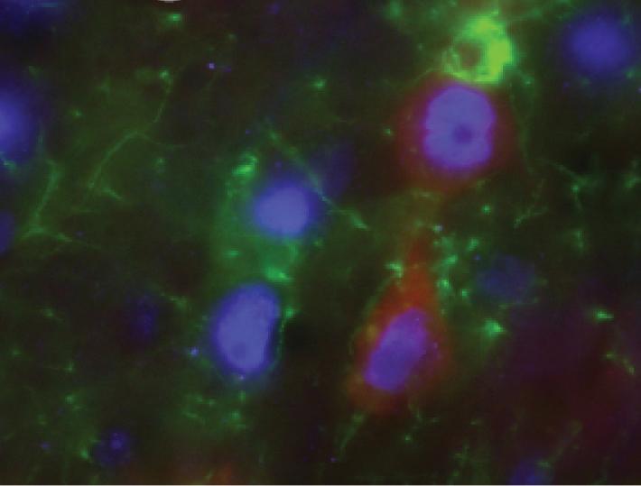 Transplanted Neural Progenitor Cells