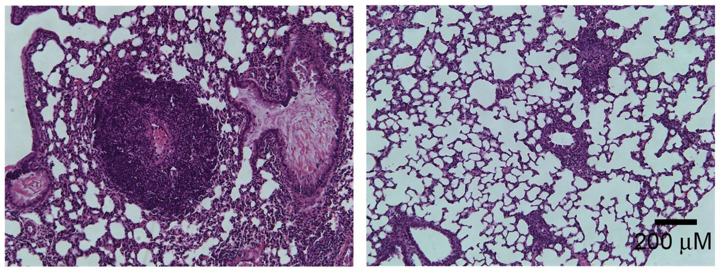 Lung Inflammation in Foxp3-mutant Mice
