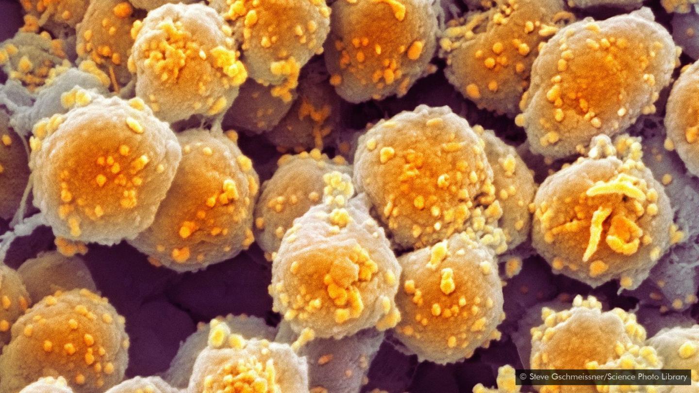 Image of Archaea