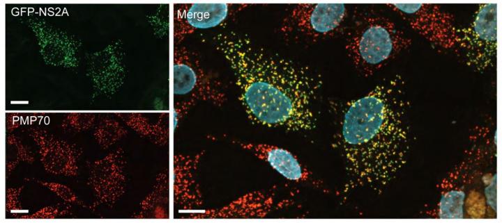 The Cellular Neighborhoods Where Zika Hides Out