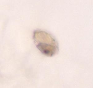 Two corallicolid cells in a membrane