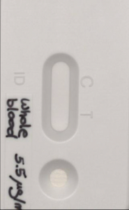 A lateral flow assay for calprotectin.