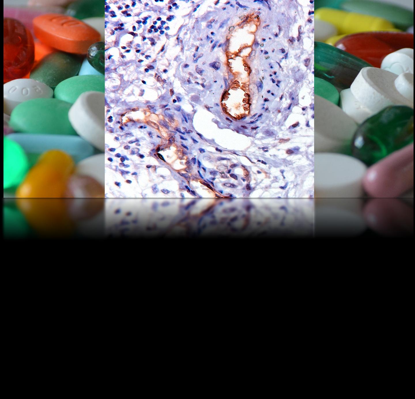 Immunohistochemical Staining