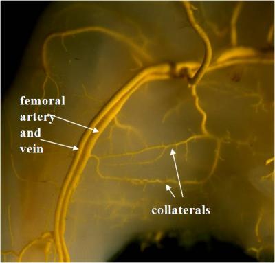 Collateral Blood Vessels
