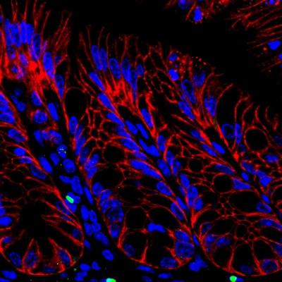 Innate Lymphoid Cells in the Intestine of Healthy Mice