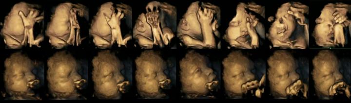 4-D Scan Image of Fetuses