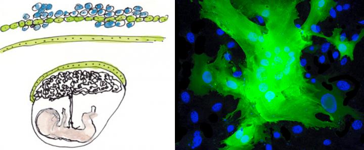 Artist's Representation of Cells and Placenta