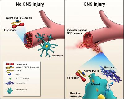 Illustration of Nervous System Injury