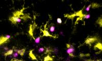Dendritic Cells Testing T-Cells for Autoreactivity