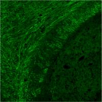 Regeneration of myelin in the brain