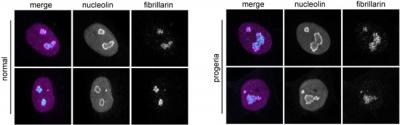 Nucleoli Enlarged in Aging Cells