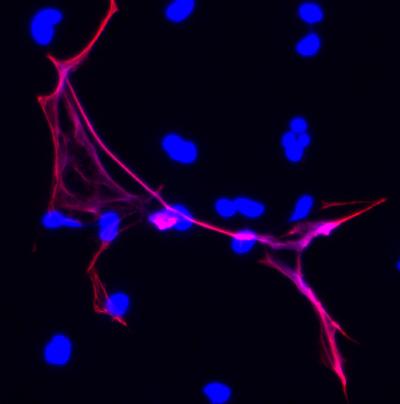 Gene Offers Clues to New Treatments for a Harmful Blood Clotting Disorder