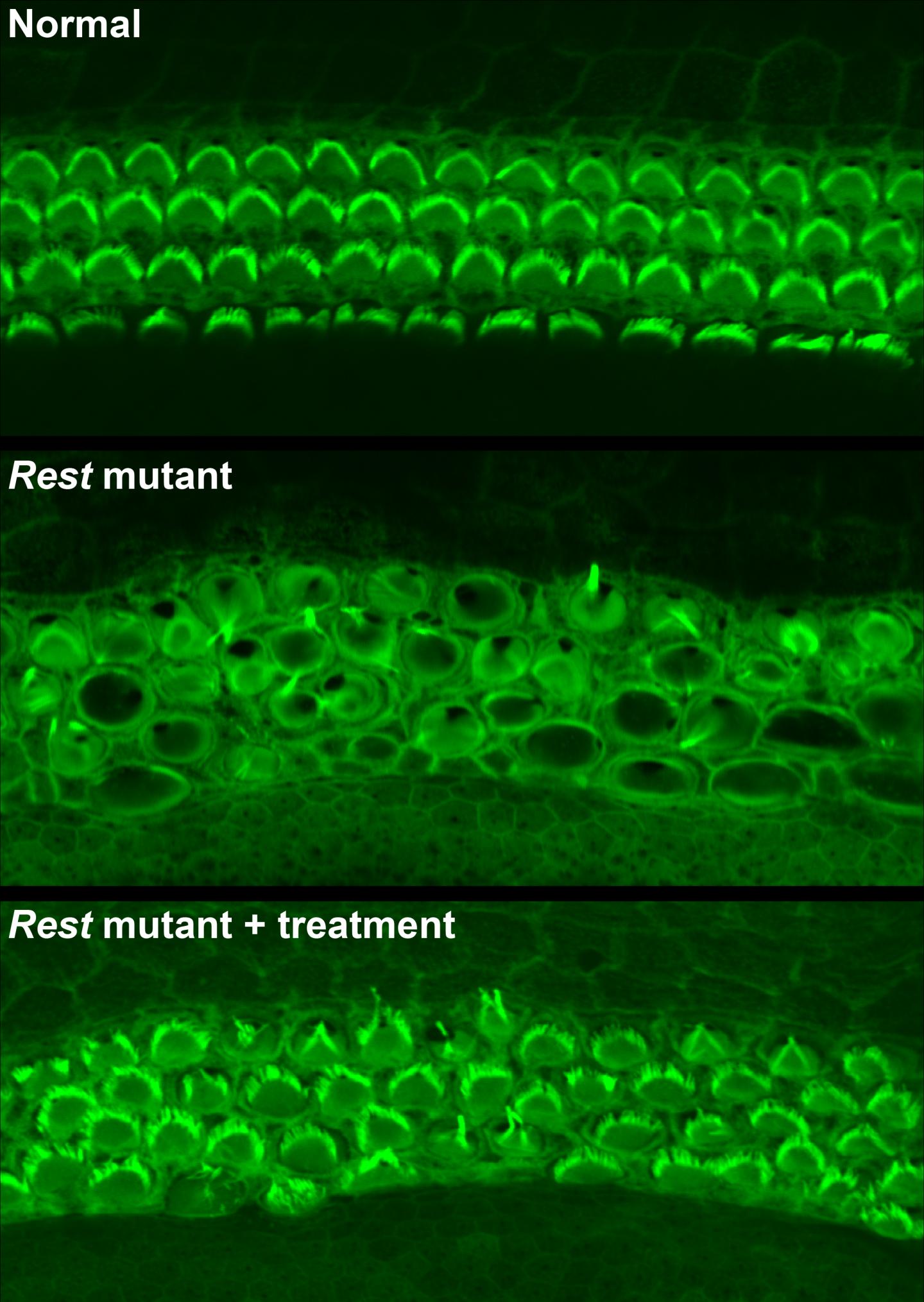 Hair Cells in Mouse Cochlea