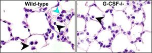 Researchers Find Promising Candidate to Treat Irreversible Lung and Eye Diseases in Extremely Premature Infants