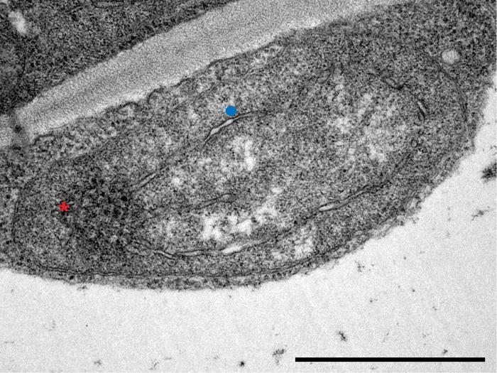 Electron microscopic image of a peculiar, non-photosynthetic plastid