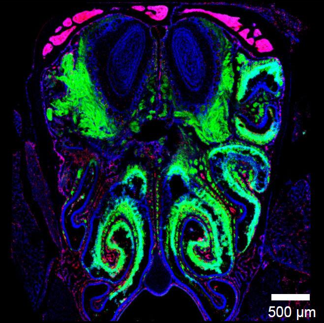 Viral Infection Thwarted Just outside the CNS