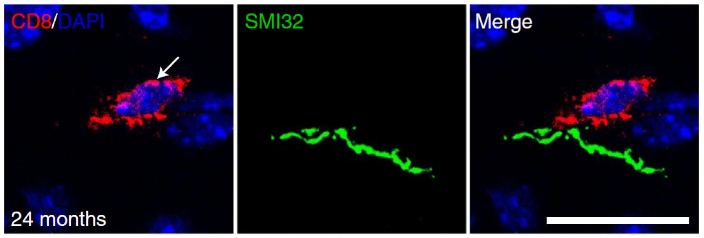 CD8+ T cell in the CNS