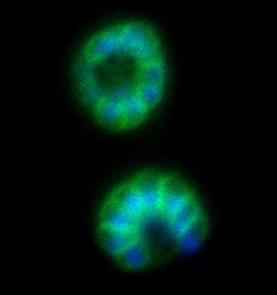 Study Finds New Vulnerability in Malaria Parasite