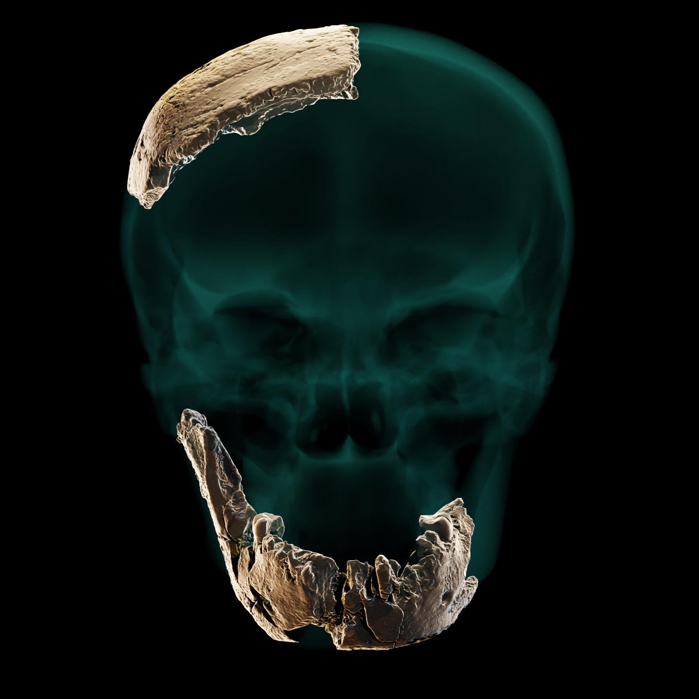 Static skull & mandible & parietal orthographic.