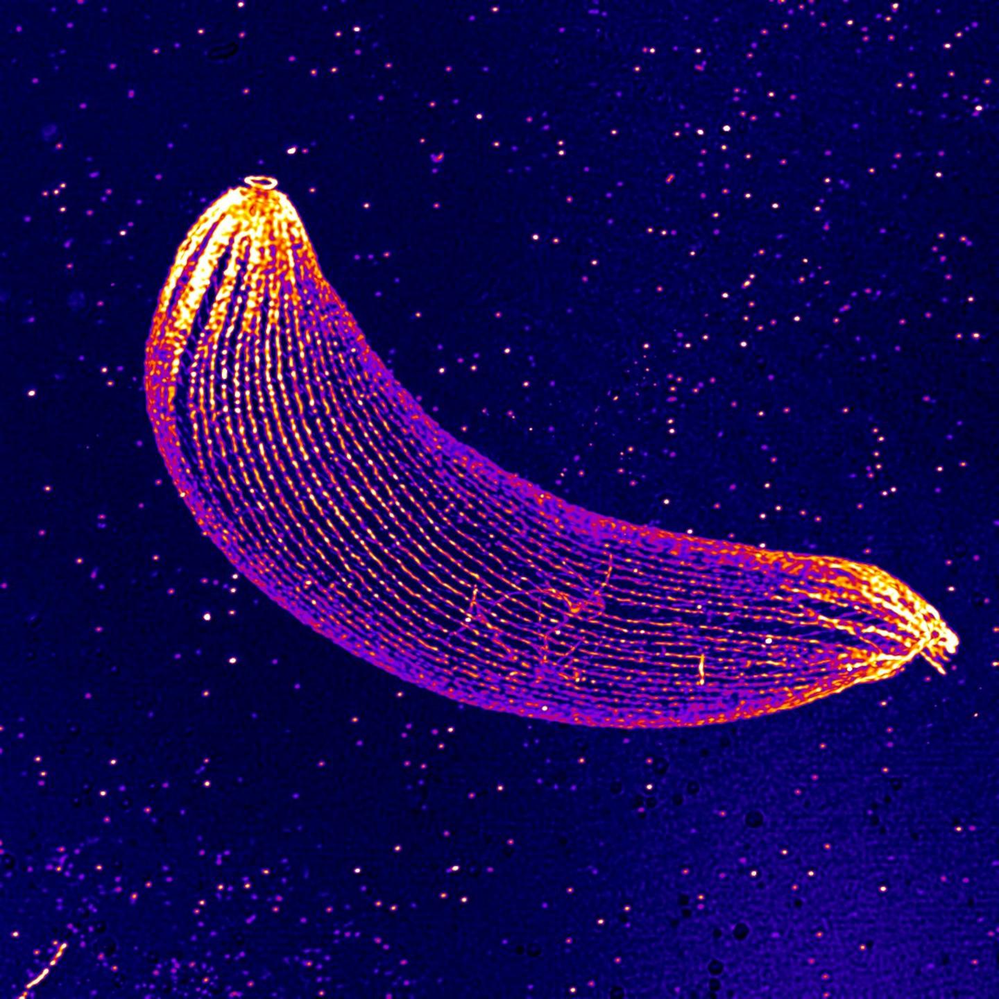 The Skeleton of the Malaria Parasite Reveals Its Secrets